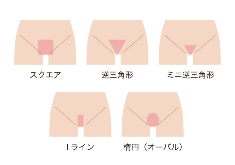 ストラッシュVIO脱毛パックプランのVラインパターン